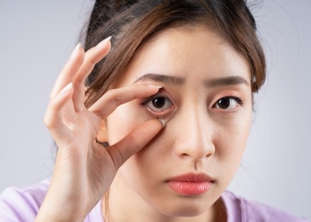 각막강화술