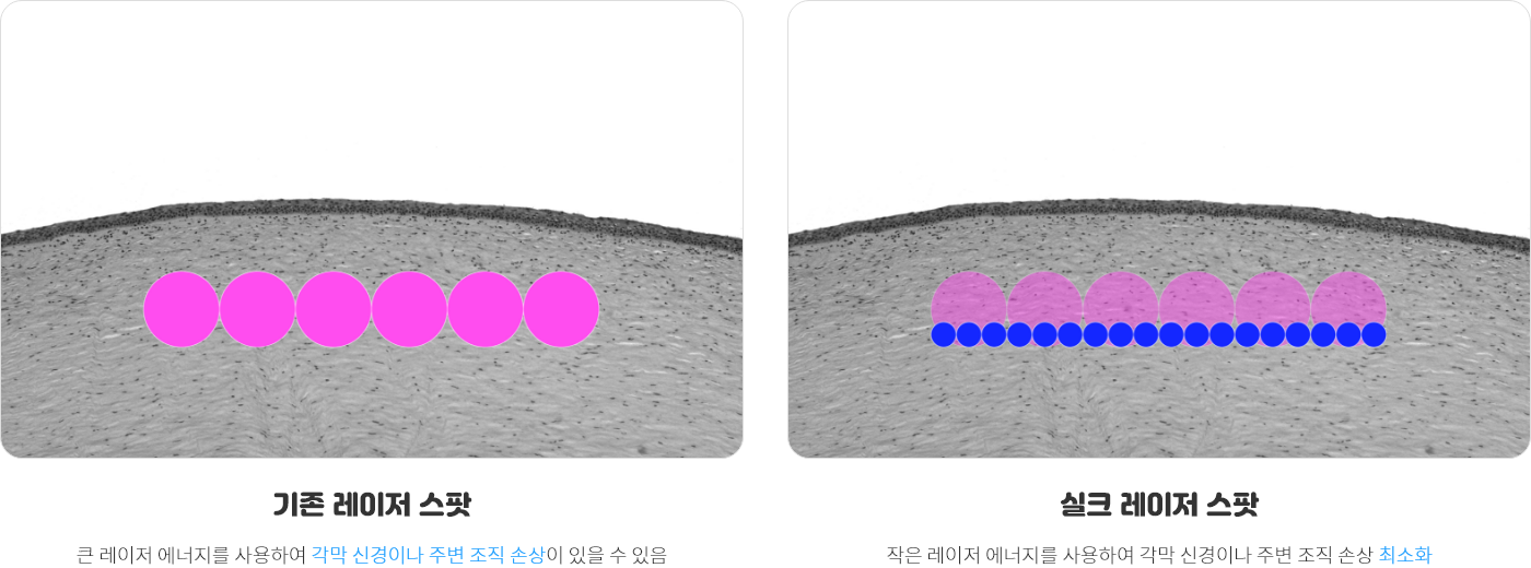 실크라식 09 1